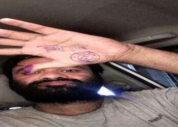 डॉ.कफील खान प्रकरण; युपी सरकारला सर्वोच्च न्यायालयाकडून झटका