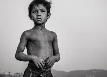 कुषोपण एक आव्हान A challenge to malnutrition 2022