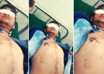 मंदिर प्रवेश केला म्हणून दलित तरुणास मारहाण A Dalit youth who was taking darshan of God in a temple in Uttarakhand was brutally beaten; Attempt to burn alive